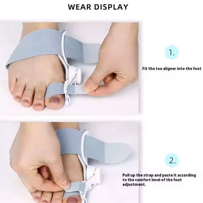 اسپلینت طبی اصلاح کننده حرکت انحرافی شست پا